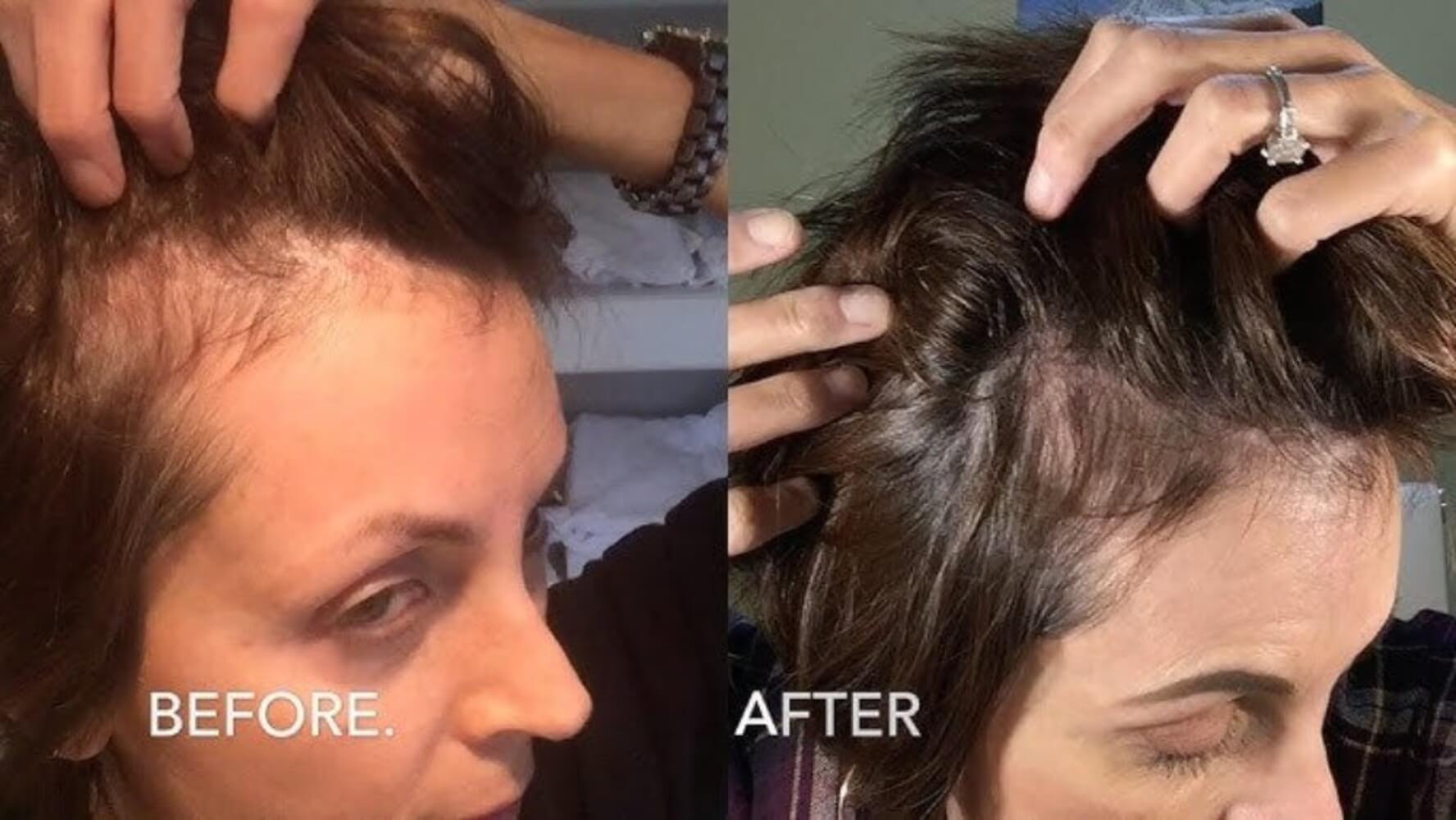 Before and after shots of a womens scalp after using the Gua Sha Comb
