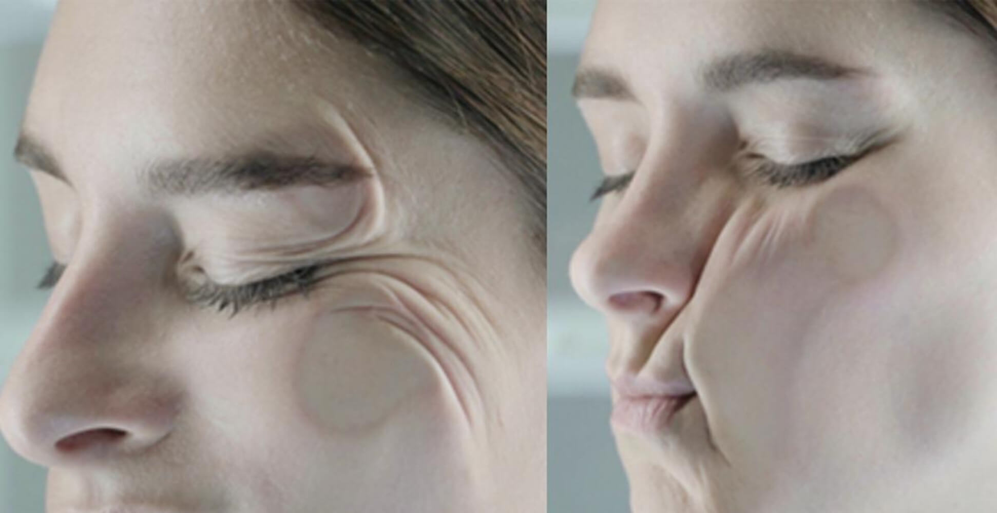 A models wrinkled face after using a normal pillow.